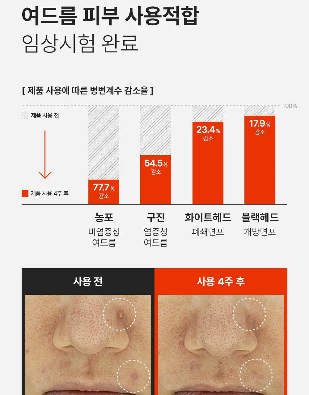 [트러블케어/스팟진정] 퍼셀 익스트림 이펙트 터피네올 원액 10ml 상세페이지 9